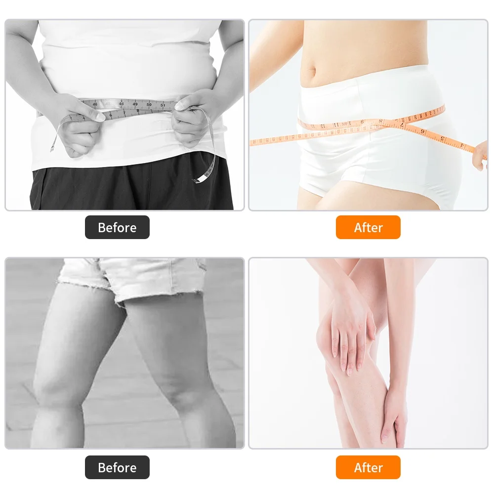 3 in1 40K Ultrasonic Cavitation Machine Body Slimming Massager RF Weight Loss Beauty Skin Tighten Lift Skin Rejuvenation (shippe 3 in1 40K Ultrasonic Cavitation Machine Body Slimming Massager RF Weight Loss Beauty Skin Tighten Lift Skin Rejuvenation (shippe