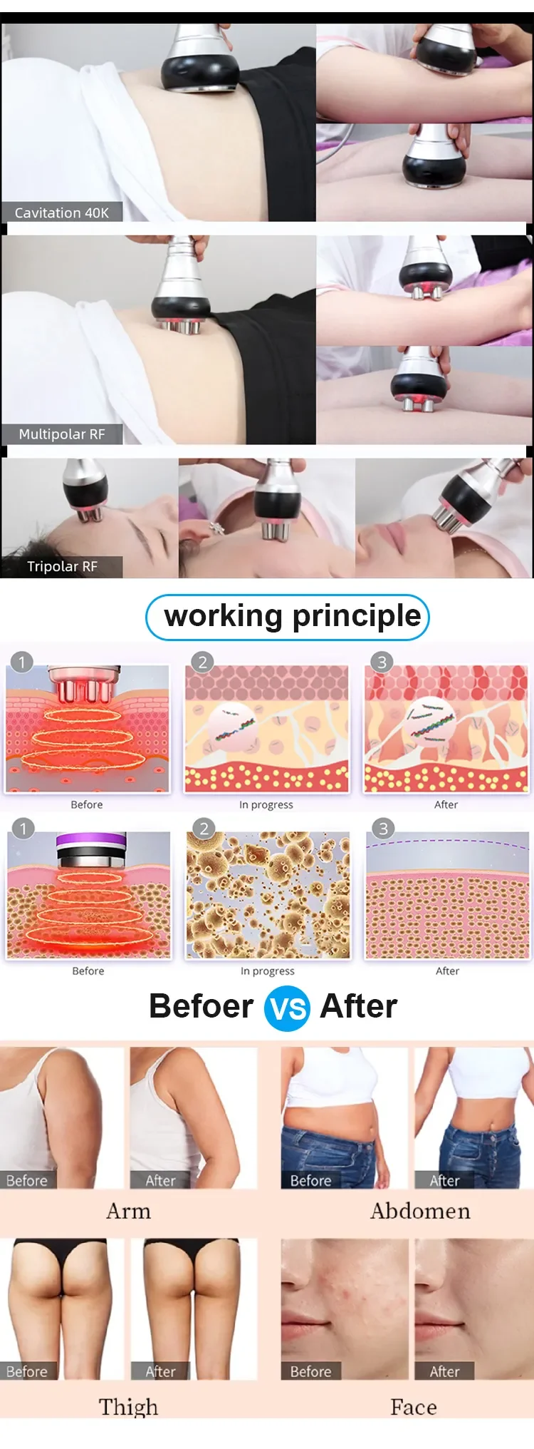 3 in1 40K Ultrasonic Cavitation Machine Body Slimming Massager RF Weight Loss Beauty Skin Tighten Lift Skin Rejuvenation (shippe 3 in1 40K Ultrasonic Cavitation Machine Body Slimming Massager RF Weight Loss Beauty Skin Tighten Lift Skin Rejuvenation (shippe